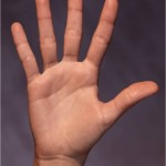 five
